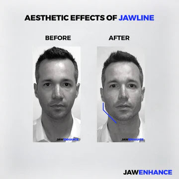 Jaw Trainer